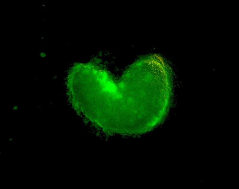 Congratulation to Dr. Hemayet Ullah for finding the Achilles’ heel of coronaviruses